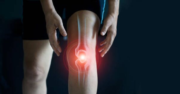 Arthrose van het kniegewricht