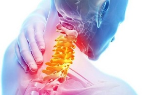 symptomen van osteochondrose van de cervicale wervelkolom