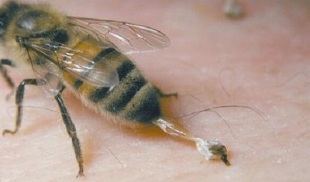 behandeling van heupartrose door bijen